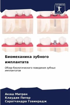 Biomehanika zubnogo implantata - MITRAN, AKASh;Piter, Klaudiq;Gowinradzh, Saratchandra