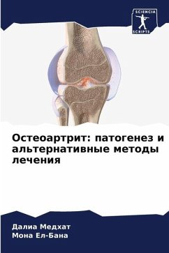 Osteoartrit: patogenez i al'ternatiwnye metody lecheniq - Medhat, Dalia;El-Bana, Mona