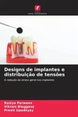 Designs de implantes e distribuição de tensões