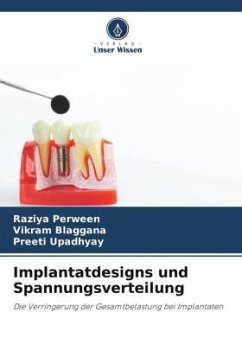 Implantatdesigns und Spannungsverteilung - Perween, Raziya;Blaggana, Vikram;Upadhyay, Preeti