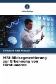 MRI-Bildsegmentierung zur Erkennung von Hirntumoren