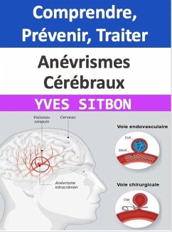 Anévrismes Cérébraux : Comprendre, Prévenir, Traiter (eBook, ePUB) - Sitbon, Yves