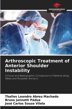 Arthroscopic Treatment of Anterior Shoulder Instability - Abreu Machado, Thalles Leandro;Pádua, Bruno Jannotti;Souza Vilela, José Carlos