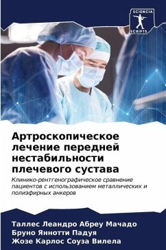 Artroskopicheskoe lechenie perednej nestabil'nosti plechewogo sustawa - Abreu Machado, Talles Leandro;Paduq, Bruno Yannotti;Souza Vilela, Zhoze Karlos