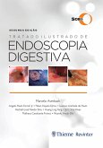 Tratado Ilustrado de Endoscopia Digestiva (eBook, ePUB)