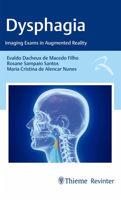 Dysphagia (eBook, ePUB) - Macedo Filho, Evaldo Dacheux de; Santos, Rosane Sampaio; Nunes, Maria Cristina de Alencar