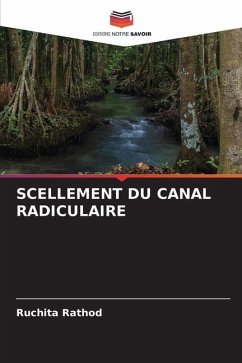 SCELLEMENT DU CANAL RADICULAIRE - Rathod, Ruchita