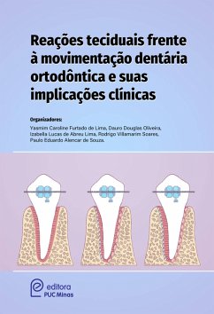 Cover Reações teciduais frente à movimentação dentária ortodóntica e suas implicações clínicas (eBook, ePUB)