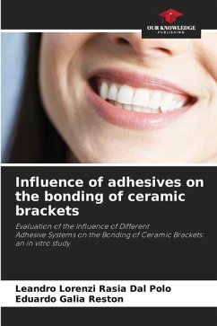 Influence of adhesives on the bonding of ceramic brackets - Dal Polo, Leandro Lorenzi Rasia;Reston, Eduardo Galia
