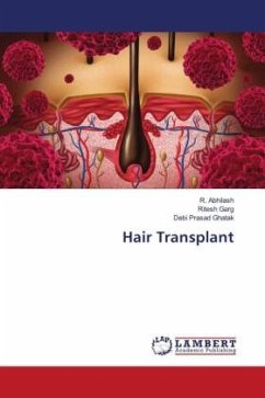 Hair Transplant - Abhilash, R.;Garg, Ritesh;Ghatak, Debi Prasad