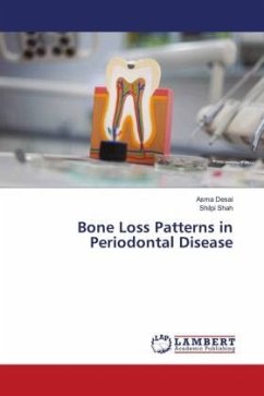 Bone Loss Patterns in Periodontal Disease - Desai, Asma;Shah, Shilpi