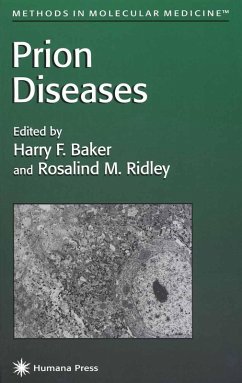 Prion Diseases (eBook, PDF)