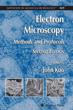 Cover Electron Microscopy (eBook, PDF)