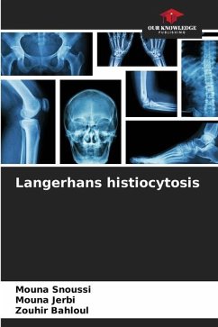 Langerhans histiocytosis - SNOUSSI, MOUNA;Jerbi, Mouna;Bahloul, Zouhir