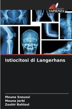 Istiocitosi di Langerhans - SNOUSSI, MOUNA;Jerbi, Mouna;Bahloul, Zouhir