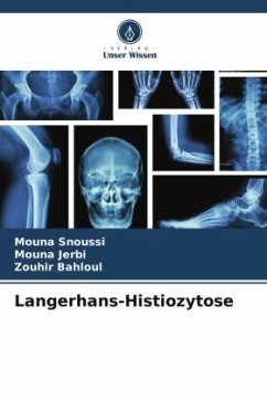 Langerhans-Histiozytose - SNOUSSI, MOUNA;Jerbi, Mouna;Bahloul, Zouhir