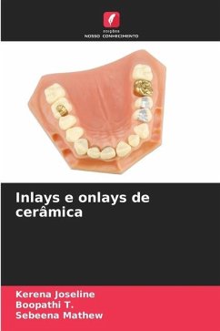 Inlays e onlays de cerâmica - Joseline, Kerena;T., Boopathi;Mathew, Sebeena