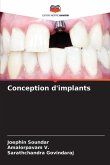 Conception d'implants