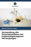 Verwendung des Zwischenaufbaus bei implantatgetragenen Versorgungen