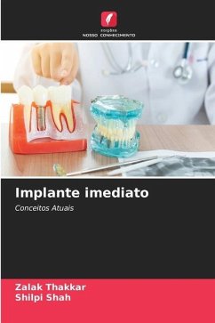 Implante imediato - Thakkar, Zalak;Shah, Shilpi