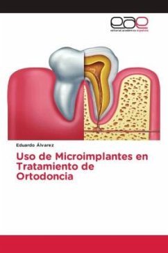 Uso de Microimplantes en Tratamiento de Ortodoncia - Álvarez, Eduardo