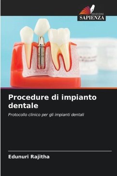 Procedure di impianto dentale - Rajitha, Edunuri