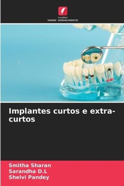 Implantes curtos e extra-curtos - Sharan, Smitha;D.L, Sarandha;Pandey, Shelvi