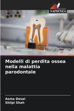 Modelli di perdita ossea nella malattia parodontale - Desai, Asma;Shah, Shilpi