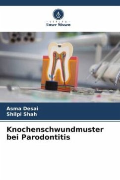 Knochenschwundmuster bei Parodontitis - Desai, Asma;Shah, Shilpi