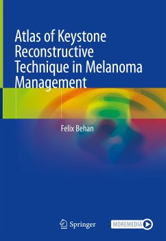 Atlas of Keystone Reconstructive Technique in Melanoma Management (eBook, PDF) - Behan, Felix