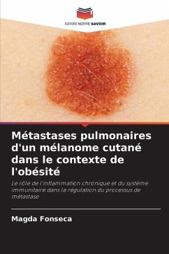 Métastases pulmonaires d'un mélanome cutané dans le contexte de l'obésité - Fonseca, Magda