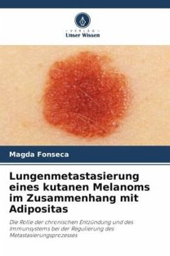 Lungenmetastasierung eines kutanen Melanoms im Zusammenhang mit Adipositas - Fonseca, Magda