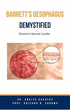 Barretts Oesophagus Demystified: Doctor's Secret Guide (eBook, ePUB) - Kashyap, Ankita; Sharma, Krishna N.