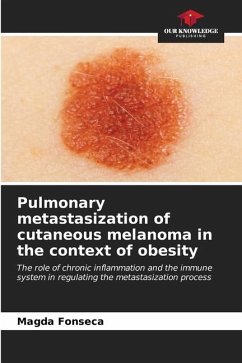 Pulmonary metastasization of cutaneous melanoma in the context of obesity - Fonseca, Magda