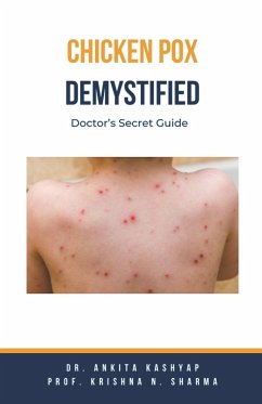 Chickenpox Demystified - Kashyap, Ankita; Sharma, Krishna N.