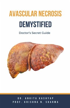 Avascular Necrosis Demystified - Kashyap, Ankita; Sharma, Krishna N.