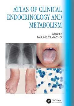 Cover Atlas of Clinical Endocrinology and Metabolism (eBook, ePUB)