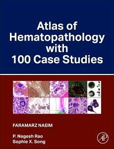 Atlas of Hematopathology with 100 Case Studies - Naeim, Faramarz; Rao, P Nagesh; Song, Sophie X