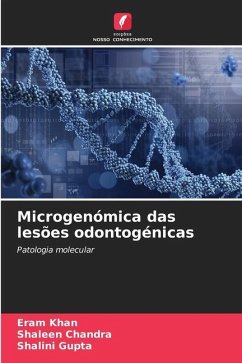 Microgenómica das lesões odontogénicas - Khan, Eram;Chandra, Shaleen;Gupta, Shalini