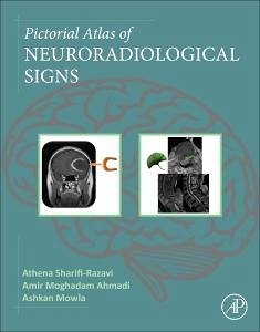Pictorial Atlas of Neuroradiological Signs - Sharifi-Razavi, Athena; Ahmadi, Amir Moghadam; Mowla, Ashkan