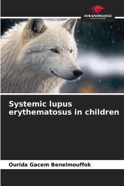 Systemic lupus erythematosus in children - GACEM BENELMOUFFOK, Ourida