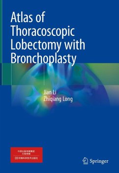Atlas of Thoracoscopic Lobectomy with Bronchoplasty (eBook, PDF) - Li, Jian; Long, Zhiqiang