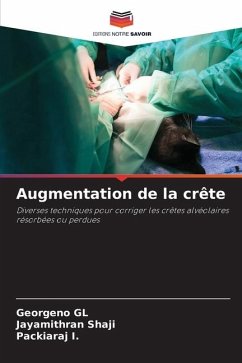 Augmentation de la crête - GL, Georgeno;Shaji, Jayamithran;I., Packiaraj