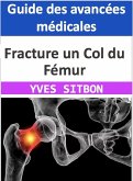 Fracture un Col du Fémur : Guide des avancées médicales (eBook, ePUB)