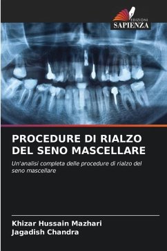 PROCEDURE DI RIALZO DEL SENO MASCELLARE - Mazhari, Khizar Hussain;Chandra, Jagadish