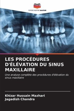 LES PROCÉDURES D'ÉLÉVATION DU SINUS MAXILLAIRE - Mazhari, Khizar Hussain;Chandra, Jagadish