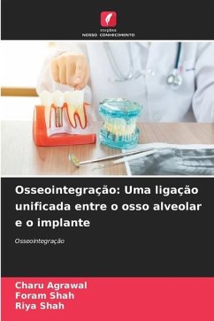 Osseointegração: Uma ligação unificada entre o osso alveolar e o implante - Agrawal, Charu;Shah, Foram;Shah, Riya