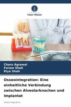Osseointegration: Eine einheitliche Verbindung zwischen Alveolarknochen und Implantat - Agrawal, Charu;Shah, Foram;Shah, Riya