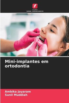 Mini-implantes em ortodontia - Jayaram, Ambika;Muddiah, Sunil