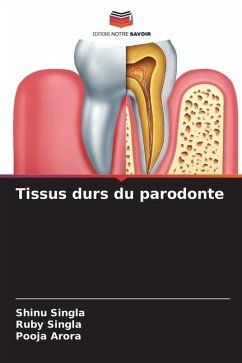Tissus durs du parodonte - Singla, Shinu;Singla, Ruby;Arora, Pooja